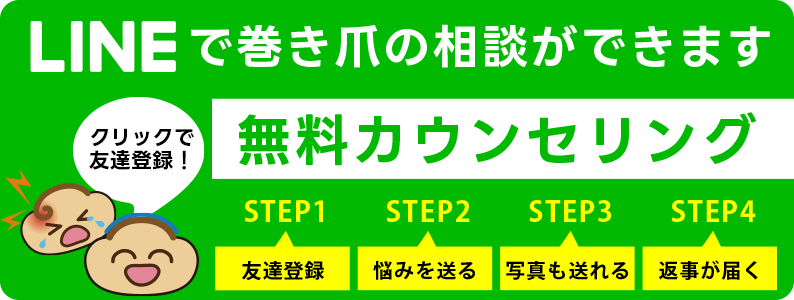 沖縄・那覇巻き爪センターへLINEで無料相談